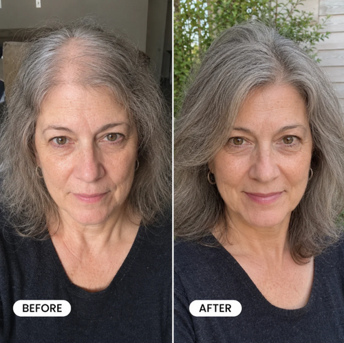Zelvara™ Advanced Follicle Repair Spray — Target Thinning & Boost Volume at the Root