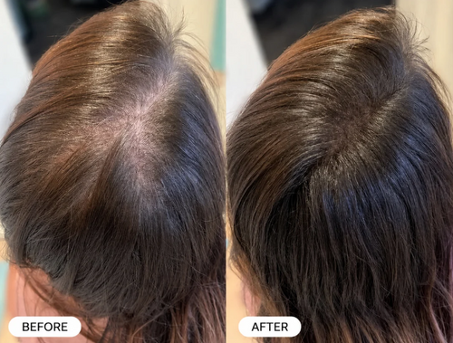 Zelvara™ Advanced Follicle Repair Spray — Target Thinning & Boost Volume at the Root